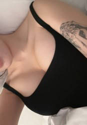 기린성형외과멘토엑스트라 가슴 1년차 찐찐찐후기