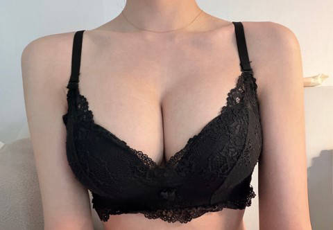 기린성형외과 가슴 3년차 되어가는 찐후기(70E 컵)