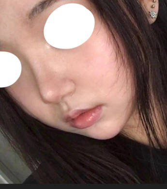 코 4개월차 후기 